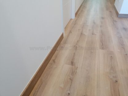 Clínica Fisioterapia Ana Cartón (Valladolid) - Imagen 79